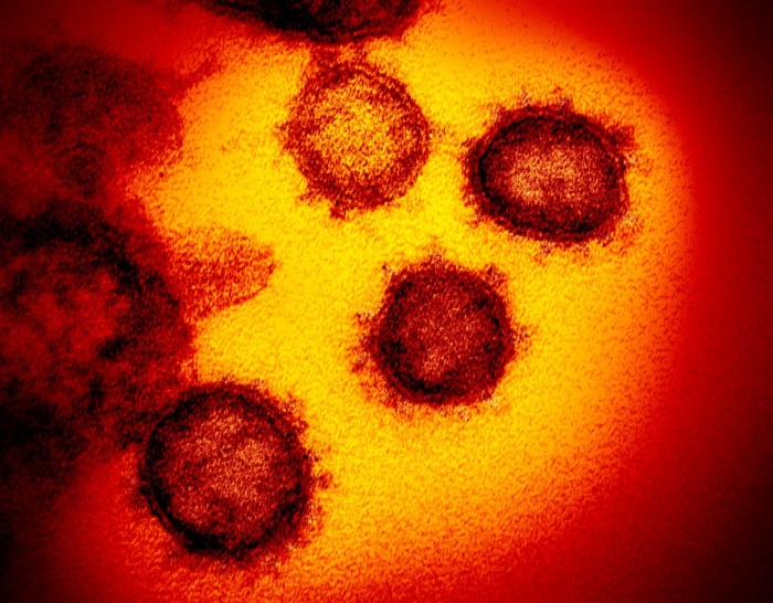 Imagem de microscópico mostra o novo coronavírus, responsável pela doença chamada Covid-19 - Foto: NIAID-RML/AP