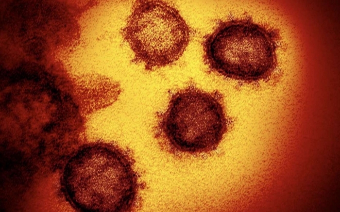 Barretos tem 14 casos positivos para coronavírus - Foto: Portal NC