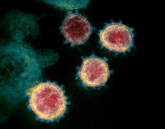 Planura registra segunda morte por coronavírus - Foto: Portal NC