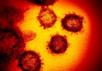 Imagem de microscópico mostra o novo coronavírus, responsável pela doença chamada Covid-19 - Foto: NIAID-RML/AP